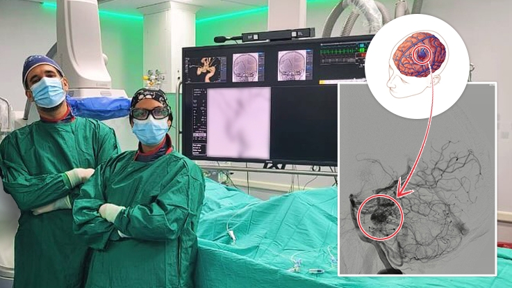 Trascendente neurocirugía de alta complejidad en el HCANK
