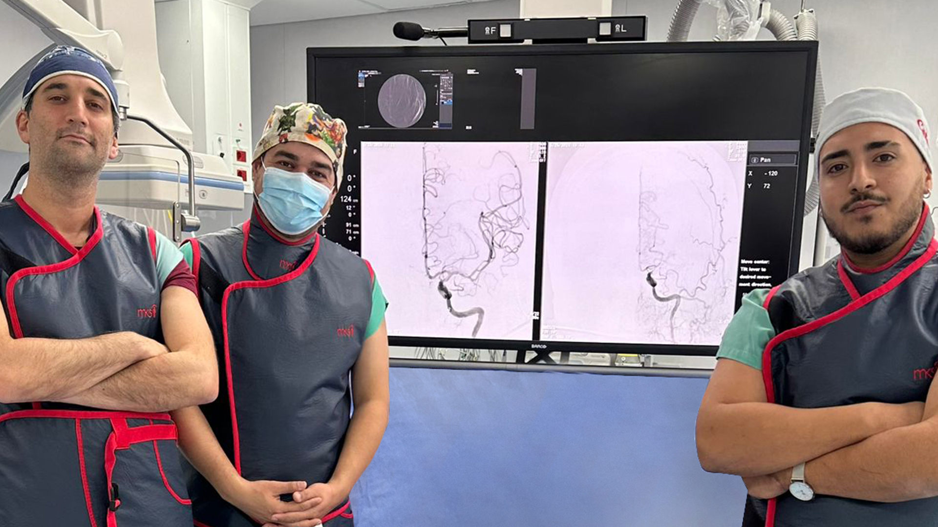 Neurocirugía: Primera trombectomía de cerebro en el HCANK