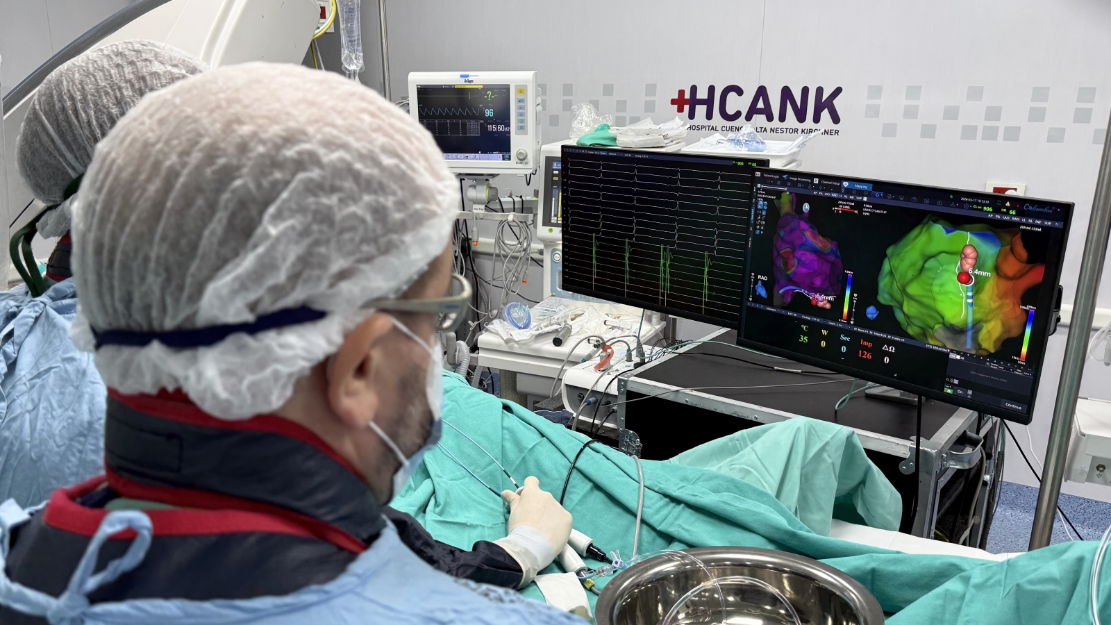 Primera ablación de arritmia cardíaca con sistema de navegación 3D en el HCANK 